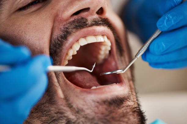 Best Emergency Dentist for Knocked-Out Tooth in Oceanport, NJ