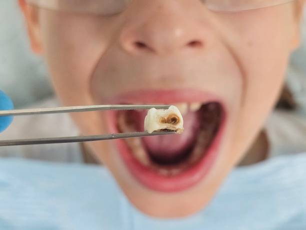 Best Weekend Emergency Dentist in Oceanport, NJ